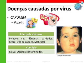 Vírus




Doenças causadas por vírus
• CAXUMBA
      – Papeira


                  Principais sintomas
  Inchaço nas glândulas parótidas.
  Febre. Dor de cabeça. Mal estar.

                           Contágio
  Saliva. Objetos contaminados.
                                                      Criança com caxumba


Ciências – 7º ano Ens. Fundamental      1º Bimestre                     Profa. Rebeca Vale
 