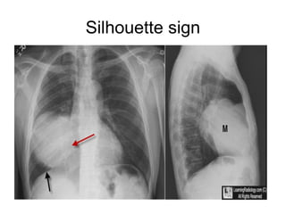 Comprehensive Overview of Chest Imaging Techniques and Diagnostic Signs ...