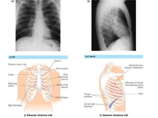 Comprehensive Overview of Chest Imaging Techniques and Diagnostic Signs ...