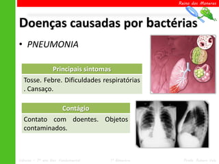 Reino dos Moneras




Doenças causadas por bactérias
• PNEUMONIA

            Principais sintomas
  Tosse. Febre. Dificuldades respiratórias
  . Cansaço.

             Contágio
  Contato com doentes. Objetos
  contaminados.



Ciências – 7º ano Ens. Fundamental   1º Bimestre     Profa. Rebeca Vale
 