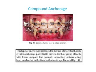Compound Anchorage
 