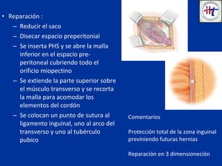• Reparación :
– Reducir el saco
– Disecar espacio preperitonial
– Se inserta PHS y se abre la malla
inferior en el espacio pre-
peritoneal cubriendo todo el
orificio miopectino
– Se extiende la parte superior sobre
el músculo transverso y se recorta
la malla para acomodar los
elementos del cordón
– Se colocan un punto de sutura al
ligamento inguinal, uno al arco del
transverso y uno al tubérculo
pubico
Comentarios
Protección total de la zona inguinal
previniendo futuras hernias
Reparación en 3 dimensioneción
 