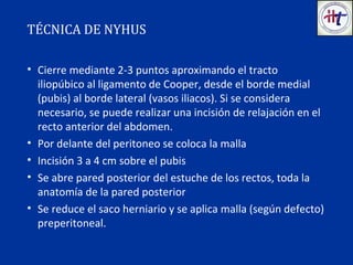 • Cierre mediante 2-3 puntos aproximando el tracto
iliopúbico al ligamento de Cooper, desde el borde medial
(pubis) al borde lateral (vasos iliacos). Si se considera
necesario, se puede realizar una incisión de relajación en el
recto anterior del abdomen.
• Por delante del peritoneo se coloca la malla
• Incisión 3 a 4 cm sobre el pubis
• Se abre pared posterior del estuche de los rectos, toda la
anatomía de la pared posterior
• Se reduce el saco herniario y se aplica malla (según defecto)
preperitoneal.
TÉCNICA DE NYHUS
 