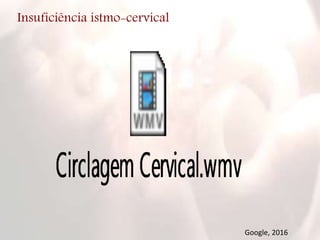 Insuficiência istmo-cervical
Google, 2016
 