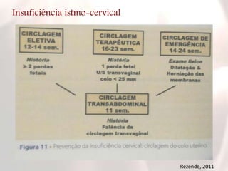 Insuficiência istmo-cervical
Rezende, 2011
 