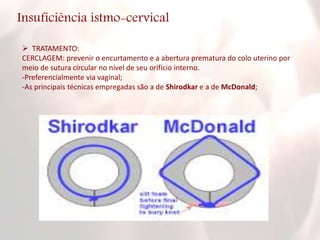 Insuficiência istmo-cervical
 TRATAMENTO:
CERCLAGEM: prevenir o encurtamento e a abertura prematura do colo uterino por
meio de sutura circular no nível de seu orifício interno.
-Preferencialmente via vaginal;
-As principais técnicas empregadas são a de Shirodkar e a de McDonald;
 
