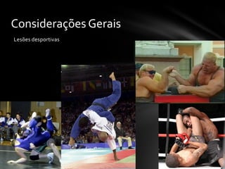 Considerações Gerais
Lesões desportivas
 