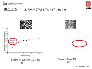 Enric Roche MD , PHD
RESULTS 2. FOAM STABILITY: Half-time life
FROTHER SYSTEM foam 2%
AIR
Tessari´s foam 2%
AIR
 