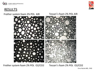 Enric Roche MD , PHD
RESULTS
Frother system foam 2% POL AIR
Frother system foam 2% POL O2/CO2
Tessari´s foam 2% POL AIR
Tessari´s foam 2% POL O2/CO2
 