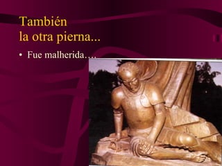 También  la otra pierna... Fue malherida…. 