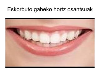 Eskorbuto gabeko hortz osantsuak O  