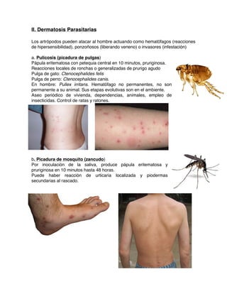 Dermatosis parasitarias