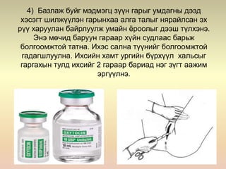 4) Базлаж буйг мэдмэгц зүүн гарыг умдагны дээд
хэсэгт шилжүүлэн гарынхаа алга талыг нярайлсан эх
рүү харуулан байрлуулж умайн ёроолыг дээш түлхэнэ.
Энэ мөчид баруун гараар хүйн судлаас барьж
болгоомжтой татна. Ихэс сална түүнийг болгоомжтой
гадагшлуулна. Ихсийн хамт ургийн бүрхүүл хальсыг
гаргахын тулд ихсийг 2 гараар бариад нэг зүгт аажим
эргүүлнэ.
 