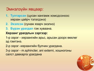 Эмнэлзүйн явцаар:
1. Тулгарсан (цусан хангамж хомсдсоноос
хярзан цайрч тэлэгдэнэ)
2. Эхэлсэн (сунаж язарч эхэлнэ)
3. Бүрэн урагдал гэж хуваана.
Хярзанг урагдлын зэргээр:
1-р зэрэг - хярзангийн арьс, арьсан доорх өөхлөг
эд гэмтэнэ.
2-р зэрэг -хярзангийн булчин урагдана.
3-р зэрэг - m.sphincter, ani externi, хошногоны
салст давхарга урагдана
 
