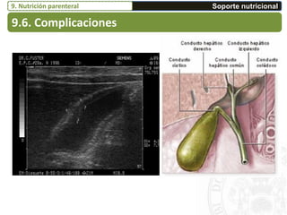 9.6. Complicaciones
Soporte nutricional9. Nutrición parenteral
 