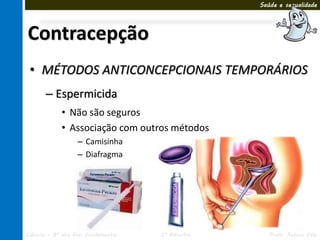 Saúde e sexualidade




Contracepção
 • MÉTODOS ANTICONCEPCIONAIS TEMPORÁRIOS
       – Espermicida
             • Não são seguros
             • Associação com outros métodos
                   – Camisinha
                   – Diafragma




Ciências – 8º ano Ens. Fundamental   3º Bimestre      Profa. Rebeca Vale
 