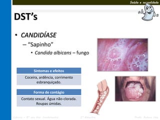 Saúde e sexualidade




DST’s
 • CANDIDÍASE
       – “Sapinho”
             • Candida albicans – fungo


               Sintomas e efeitos
        Coceira, ardência, corrimento
               esbranquiçado.

               Forma de contágio
      Contato sexual. Água não-clorada.
               Roupas úmidas.


Ciências – 8º ano Ens. Fundamental        3º Bimestre      Profa. Rebeca Vale
 
