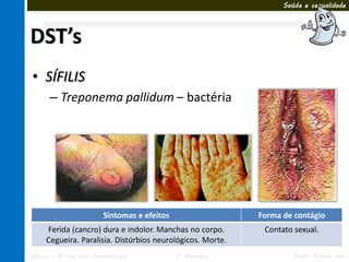 Saúde e sexualidade




DST’s
 • SÍFILIS
       – Treponema pallidum – bactéria




                         Sintomas e efeitos                  Forma de contágio
      Ferida (cancro) dura e indolor. Manchas no corpo.       Contato sexual.
      Cegueira. Paralisia. Distúrbios neurológicos. Morte.
Ciências – 8º ano Ens. Fundamental            3º Bimestre             Profa. Rebeca Vale
 