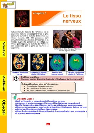 SituationProblèmeObjectifs
Actuellement, la maladie de Parkinson est la
deuxième maladie neurodégénératives la plus
commune, suivant la maladie d’Alzheimer. Au
niveau mondial, 305 000 personnes sont
annuellement diagnostiquées. L’incidence de la
maladie augmente grandement avec l’âge. Au
niveau pathologique, la maladie de Parkinson
est caractérisée par la perte de neurones à
dopamine.
Cerveau d’un homme
normal
Cerveau d’un homme
atteint d’Alzheimer
Problème scientifique
Comment peut-
Objectifs visés :
- établir un lien entre le comportement et le système nerveux.
- montrer que le système nerveux est le support histologique du comportement.
- identifier l’organisation des différentes parties constitutives du système nerveux.
- utiliser un microscope pour observer des préparations histologiques de tissu nerveux.
- préciser les éléments constitutifs du tissu nerveux.
- utiliser des technologies de
structure du système nerveux.
Cette problématique mène
• l’organisation du système nerveux.
• les constituants du tissu nerveux.
• les fonctions essentielles
.132.
la maladie de Parkinson est la
deuxième maladie neurodégénératives la plus
commune, suivant la maladie d’Alzheimer. Au
niveau mondial, 305 000 personnes sont
annuellement diagnostiquées. L’incidence de la
maladie augmente grandement avec l’âge. Au
niveau pathologique, la maladie de Parkinson
est caractérisée par la perte de neurones à
Mohamed Ali Clay, plus
est une légende vivante
Cerveau d’un homme
atteint d’Alzheimer
Cerveau d’un
homme normal
Cerveau d’un homme
Problème scientifique :
-on déterminer la structure histologique du tissu nerveux
établir un lien entre le comportement et le système nerveux.
montrer que le système nerveux est le support histologique du comportement.
identifier l’organisation des différentes parties constitutives du système nerveux.
utiliser un microscope pour observer des préparations histologiques de tissu nerveux.
préciser les éléments constitutifs du tissu nerveux.
utiliser des technologies de l’information et de la communication pour comprendre la
structure du système nerveux.
Cette problématique mène à s’interroger sur :
rganisation du système nerveux.
constituants du tissu nerveux.
fonctions essentielles des éléments du tissu nerveux
Mohamed Ali Clay, plus qu’un boxeur,
est une légende vivante
Cerveau d’un homme
atteint de Parkinson
histologique du tissu nerveux ?
montrer que le système nerveux est le support histologique du comportement.
identifier l’organisation des différentes parties constitutives du système nerveux.
utiliser un microscope pour observer des préparations histologiques de tissu nerveux.
l’information et de la communication pour comprendre la
tissu nerveux.
 