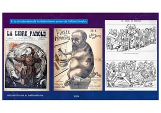 Antisémitisme et nationalisme Zola
B. La structuration de l’antisémitisme autour de l’affaire Dreyfus
 