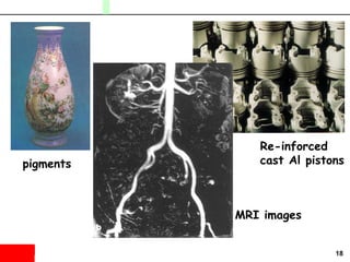 18
pigments
Re-inforced
cast Al pistons
MRI images
 