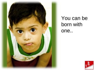 You can be
born with
one..
3
 