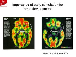 Importance of early stimulation for
brain development
Nelson CA et al. Science 2007 7
 