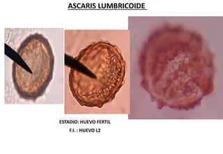 ESTADIO: HUEVO FERTIL
F.I. : HUEVO L2
ASCARIS LUMBRICOIDE