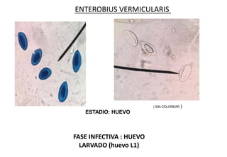 ( SIN COLOREAR )
FASE INFECTIVA : HUEVO
LARVADO (huevo L1)
ENTEROBIUS VERMICULARIS
ESTADIO: HUEVO