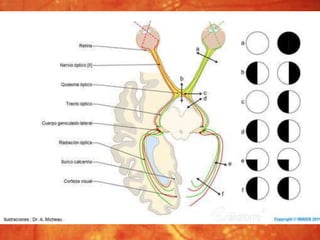 II par craneal y vía óptica