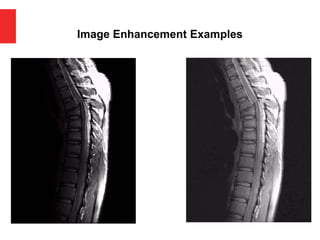 Image Enhancement Examples
 