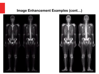 Image Enhancement Examples (cont…)
 