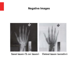 Negative Images
 
