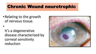Novel Biomaterials for Chronic wound Healing for Chronic wound Healing ...