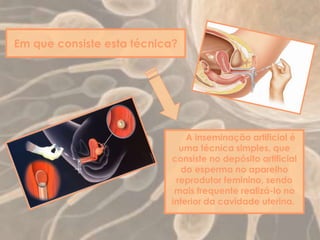 Em que consiste esta técnica?
A inseminação artificial é
uma técnica simples, que
consiste no depósito artificial
do esperma no aparelho
reprodutor feminino, sendo
mais frequente realizá-lo no
interior da cavidade uterina.
 