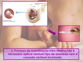 3. Processo de Inseminação Intra-Uterina não é
necessário aplicar nenhum tipo de anestesia nem é
causado nenhum incómodo.
 