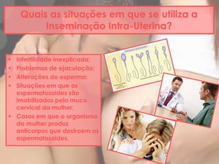 Quais as situações em que se utiliza a
Inseminação Intra-Uterina?
 Infertilidade inexplicada;
 Problemas de ejaculação;
 Alterações do esperma;
 Situações em que os
espermatozoides são
imobilizados pelo muco
cervical da mulher;
 Casos em que o organismo
da mulher produz
anticorpos que destroem os
espermatozoides.
 