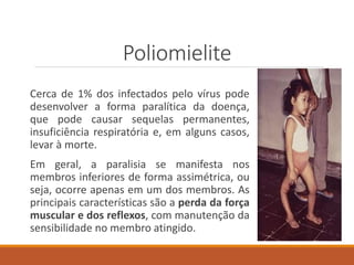 Poliomielite
Cerca de 1% dos infectados pelo vírus pode
desenvolver a forma paralítica da doença,
que pode causar sequelas permanentes,
insuficiência respiratória e, em alguns casos,
levar à morte.
Em geral, a paralisia se manifesta nos
membros inferiores de forma assimétrica, ou
seja, ocorre apenas em um dos membros. As
principais características são a perda da força
muscular e dos reflexos, com manutenção da
sensibilidade no membro atingido.
 