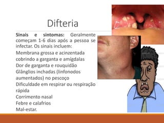 Difteria
Sinais e sintomas: Geralmente
começam 1-6 dias após a pessoa se
infectar. Os sinais incluem:
Membrana grossa e acinzentada
cobrindo a garganta e amígdalas
Dor de garganta e rouquidão
Glânglios inchadas (linfonodos
aumentados) no pescoço
Dificuldade em respirar ou respiração
rápida
Corrimento nasal
Febre e calafrios
Mal-estar.
 
