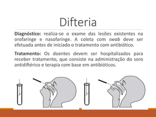 Difteria
Diagnóstico: realiza-se o exame das lesões existentes na
orofaringe e nasofaringe. A coleta com swab deve ser
efetuada antes de iniciado o tratamento com antibiótico.
Tratamento: Os doentes devem ser hospitalizados para
receber tratamento, que consiste na administração do soro
antidiftérico e terapia com base em antibióticos.
 