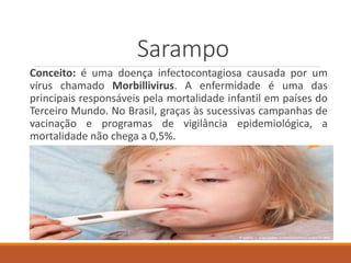 Sarampo
Conceito: é uma doença infectocontagiosa causada por um
vírus chamado Morbillivirus. A enfermidade é uma das
principais responsáveis pela mortalidade infantil em países do
Terceiro Mundo. No Brasil, graças às sucessivas campanhas de
vacinação e programas de vigilância epidemiológica, a
mortalidade não chega a 0,5%.
 