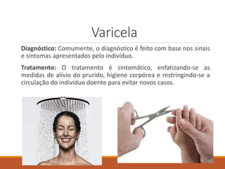 Varicela
Diagnóstico: Comumente, o diagnóstico é feito com base nos sinais
e sintomas apresentados pelo indivíduo.
Tratamento: O tratamento é sintomático, enfatizando-se as
medidas de alívio do prurido, higiene corpórea e restringindo-se a
circulação do indivíduo doente para evitar novos casos.
 