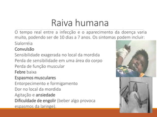 Raiva humana
O tempo real entre a infecção e o aparecimento da doença varia
muito, podendo ser de 10 dias a 7 anos. Os sintomas podem incluir:
Sialorréia
Convulsão
Sensibilidade exagerada no local da mordida
Perda de sensibilidade em uma área do corpo
Perda de função muscular
Febre baixa
Espasmos musculares
Entorpecimento e formigamento
Dor no local da mordida
Agitação e ansiedade
Dificuldade de engolir (beber algo provoca
espasmos da laringe).
 