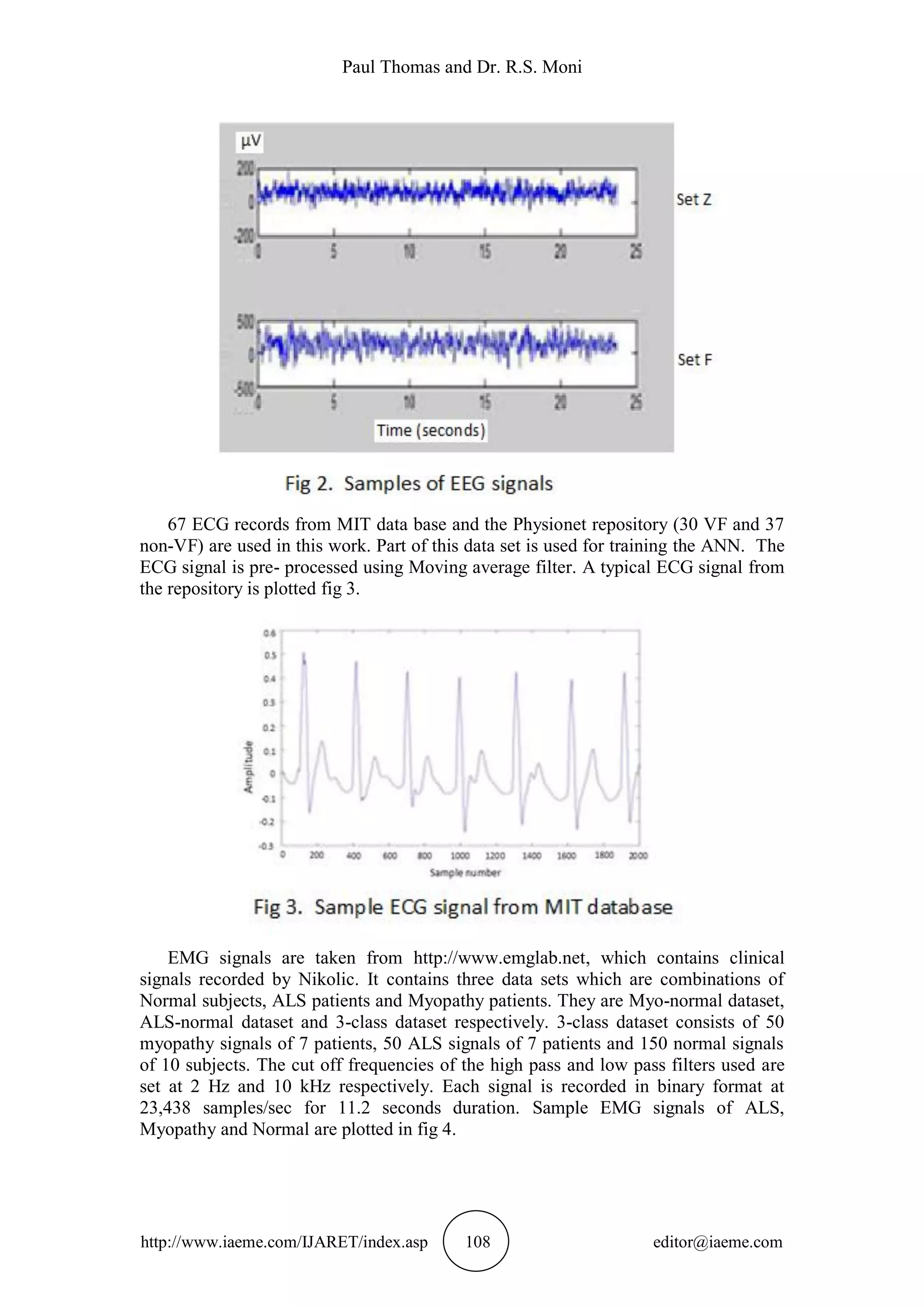 Paul Thomas and Dr. R.S. Moni
http://www.iaeme.com/IJARET/index.asp 108 editor@iaeme.com
67 ECG records from MIT data base and the Physionet repository (30 VF and 37
non-VF) are used in this work. Part of this data set is used for training the ANN. The
ECG signal is pre- processed using Moving average filter. A typical ECG signal from
the repository is plotted fig 3.
EMG signals are taken from http://www.emglab.net, which contains clinical
signals recorded by Nikolic. It contains three data sets which are combinations of
Normal subjects, ALS patients and Myopathy patients. They are Myo-normal dataset,
ALS-normal dataset and 3-class dataset respectively. 3-class dataset consists of 50
myopathy signals of 7 patients, 50 ALS signals of 7 patients and 150 normal signals
of 10 subjects. The cut off frequencies of the high pass and low pass filters used are
set at 2 Hz and 10 kHz respectively. Each signal is recorded in binary format at
23,438 samples/sec for 11.2 seconds duration. Sample EMG signals of ALS,
Myopathy and Normal are plotted in fig 4.
 