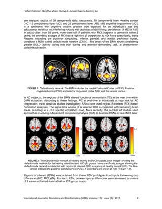 Evaluation of Default Mode Network In Mild Cognitive Impairment and ...