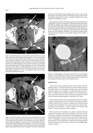 Role of computed tomography in the evaluation of blunt abdominal trauma ...