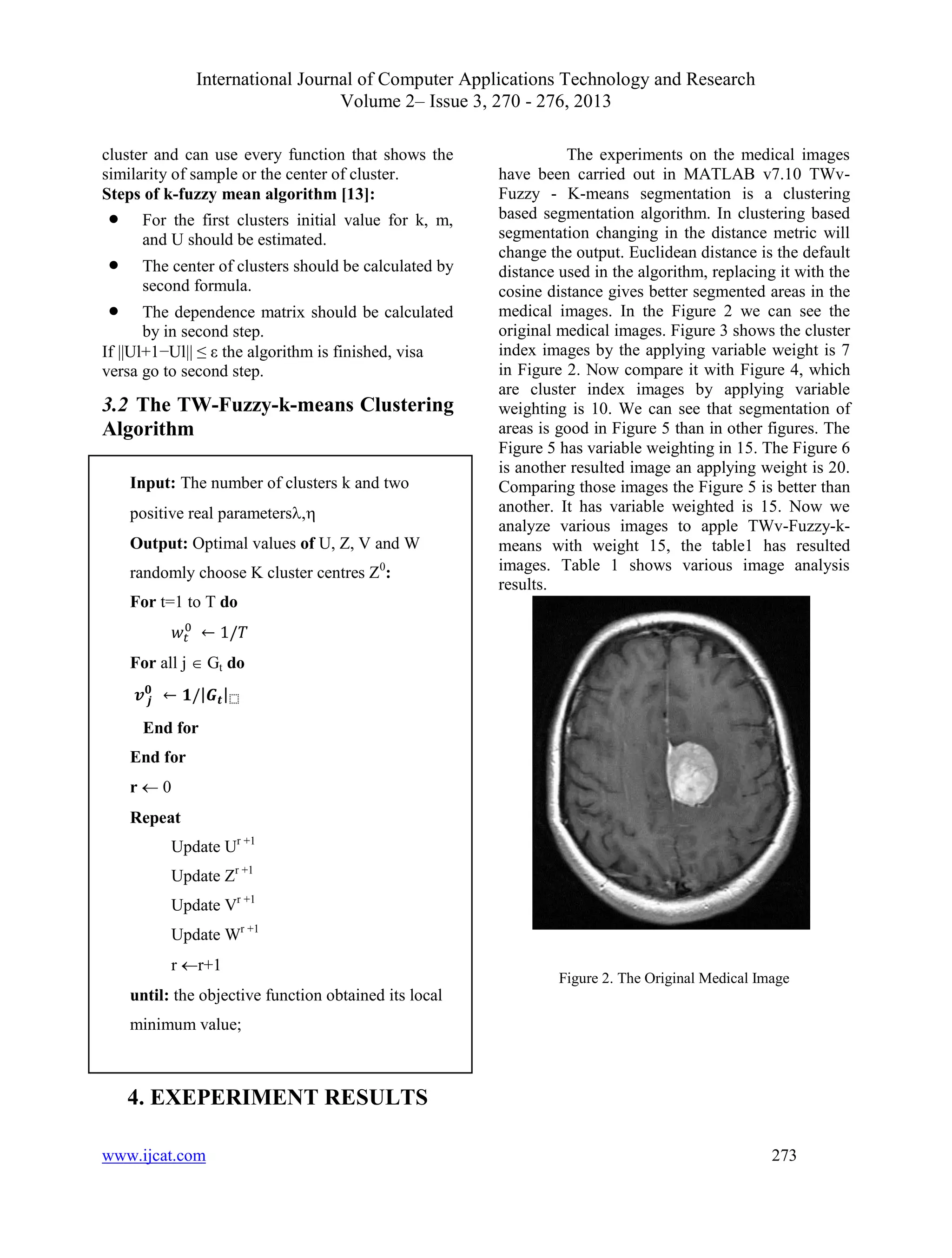 International Journal of Computer Applications Technology and Research
Volume 2– Issue 3, 270 - 276, 2013
www.ijcat.com 273
cluster and can use every function that shows the
similarity of sample or the center of cluster.
Steps of k-fuzzy mean algorithm [13]:
 For the first clusters initial value for k, m,
and U should be estimated.
 The center of clusters should be calculated by
second formula.
 The dependence matrix should be calculated
by in second step.
If ||Ul+1−Ul|| ≤ ε the algorithm is finished, visa
versa go to second step.
3.2 The TW-Fuzzy-k-means Clustering
Algorithm
4. EXEPERIMENT RESULTS
The experiments on the medical images
have been carried out in MATLAB v7.10 TWv-
Fuzzy - K-means segmentation is a clustering
based segmentation algorithm. In clustering based
segmentation changing in the distance metric will
change the output. Euclidean distance is the default
distance used in the algorithm, replacing it with the
cosine distance gives better segmented areas in the
medical images. In the Figure 2 we can see the
original medical images. Figure 3 shows the cluster
index images by the applying variable weight is 7
in Figure 2. Now compare it with Figure 4, which
are cluster index images by applying variable
weighting is 10. We can see that segmentation of
areas is good in Figure 5 than in other figures. The
Figure 5 has variable weighting in 15. The Figure 6
is another resulted image an applying weight is 20.
Comparing those images the Figure 5 is better than
another. It has variable weighted is 15. Now we
analyze various images to apple TWv-Fuzzy-k-
means with weight 15, the table1 has resulted
images. Table 1 shows various image analysis
results.
Figure 2. The Original Medical Image
Input: The number of clusters k and two
positive real parameters,
Output: Optimal values of U, Z, V and W
randomly choose K cluster centres Z0
:
For t=1 to T do
𝑤𝑡 ← 1/𝑇
For all j  Gt do
𝒗 𝒋
𝟎
← 𝟏/|𝑮𝒕|⬚
End for
End for
r  0
Repeat
Update Ur +1
Update Zr +1
Update Vr +1
Update Wr +1
r r+1
until: the objective function obtained its local
minimum value;
 
