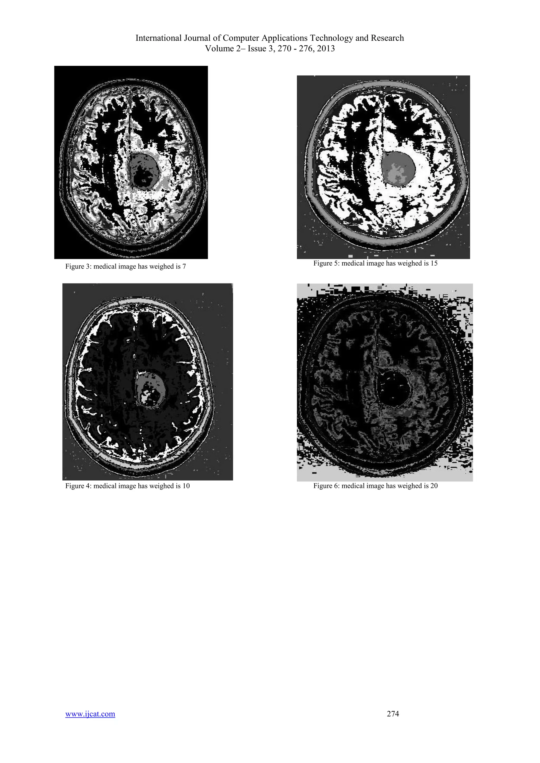 International Journal of Computer Applications Technology and Research
Volume 2– Issue 3, 270 - 276, 2013
www.ijcat.com 274
Figure 3: medical image has weighed is 7
Figure 4: medical image has weighed is 10
Figure 5: medical image has weighed is 15
Figure 6: medical image has weighed is 20
 