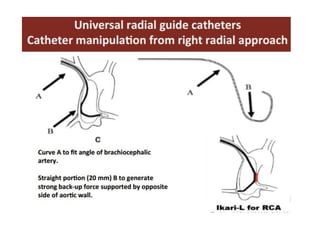 Know your instrument Guide for Angiography | PDF