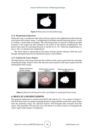 Extract the Breast Cancer in Mammogram Images
http://www.iaeme.com/IJCIET/index.asp 100 editor@iaeme.com
Figure.5: Binarization the thresholded image
3.2.4. Morphological Operation
During this step, a comparison takes place between regions and neighborhood while indexing
each region with a binary image. A morphological technique named (Structural pixels) is used
to evaluate a small shape or template. The structuring pixels are placed in different possible
locations in the image and then matched to the pixels of the identical neighborhood. The
process then starts by examining the pixel to classify if it is "fit" within the neighborhood, or
else, it "hits" or intersects the neighborhood.
The tumor region is represented by the region with the greatest intensity which has gone
through subsequent detection by labeling the regions with numbers.
3.2.5. Isolation the Cancer Region
The high-density in the image determine the isolation of the cancer region from the remaining
mammogram image. Figure 6 shows the detection and extraction of the cancer region from the
mammogram breast image.
Figure 6: Detection and Extraction of the cancer Region in mammogram breast image.
4. RESULTS AND DISCUSSIONS
The proposed application is created using MATLAB software [12, 13] as shown in Figure 7.
The GUI allows users to load the mammogram breast image and then isolated the cancer region
from the remaining image; the statistical features with histogram then extracted from this
region. This procedure will open the way in the future to use these features to distinguish the
cancer region either benign or malignancy.
 